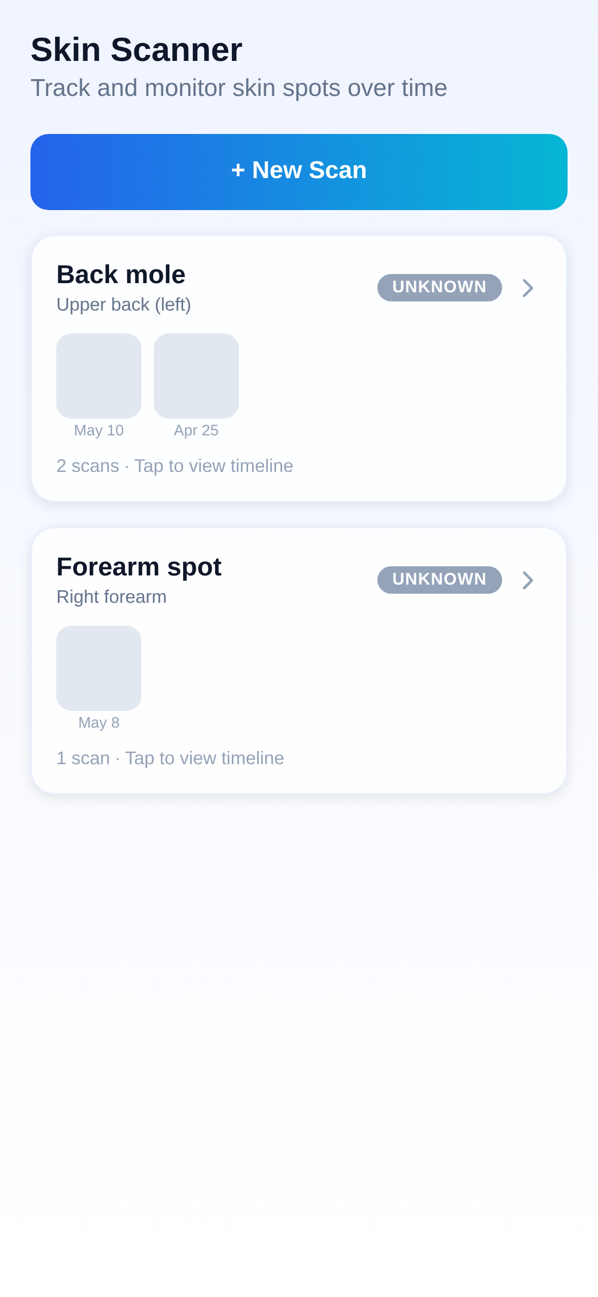 PocDoc Skin Scanner showing mole tracking with timeline of changes and AI risk assessment