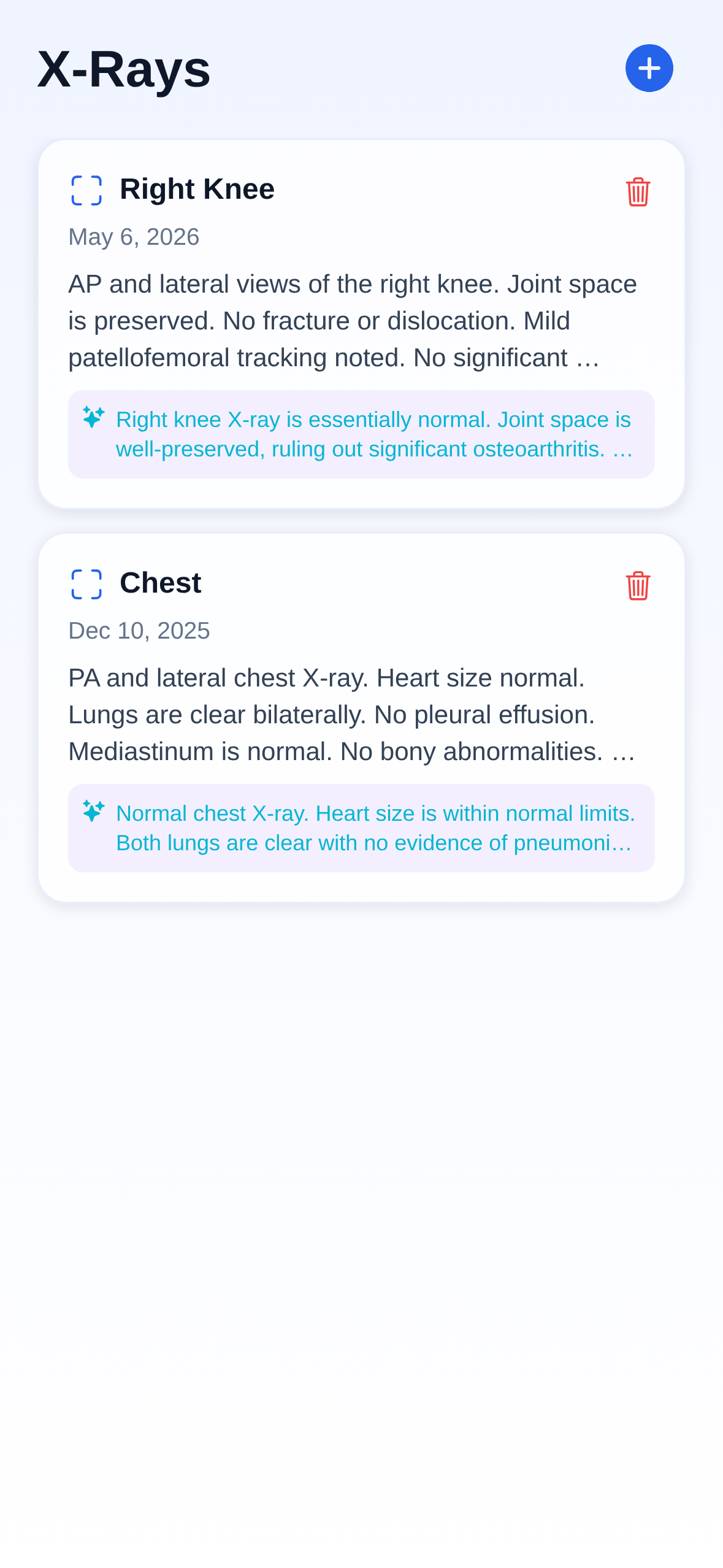 PocDoc X-Ray Records showing stored imaging with AI-assisted findings summaries